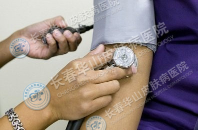 寻常型银屑病的病因是什么